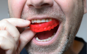red mouthguard