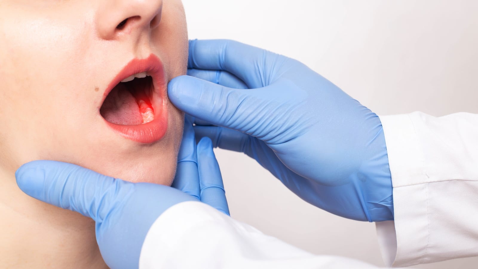 Dentist inspecting patient for oral cancer