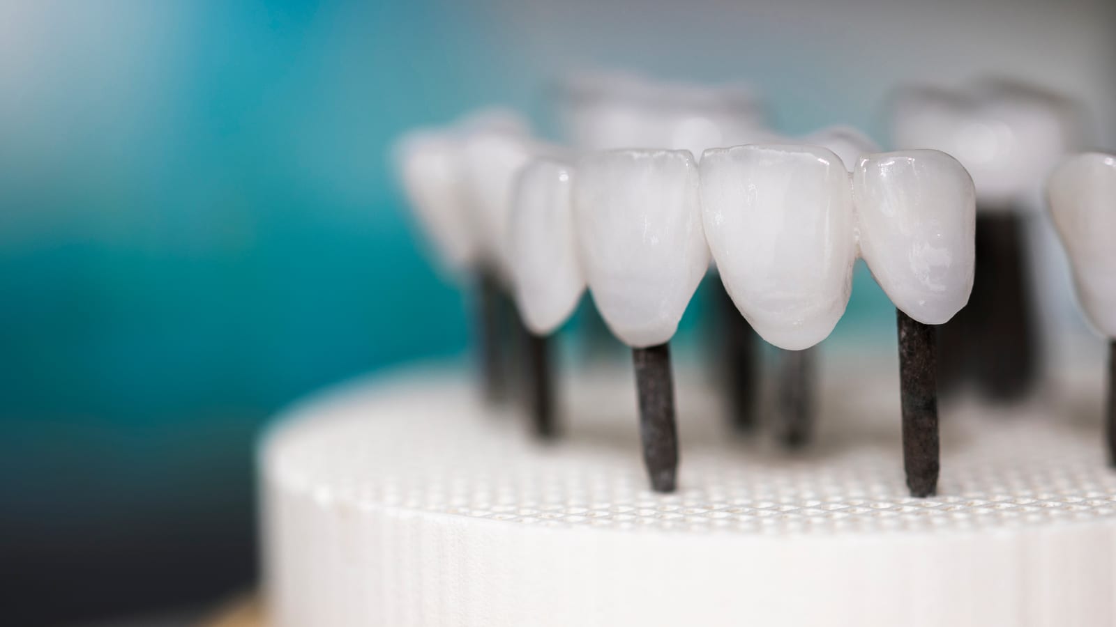 Dental Implant Examples